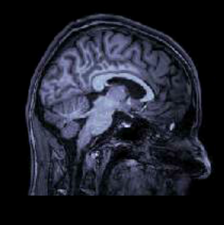 my brain